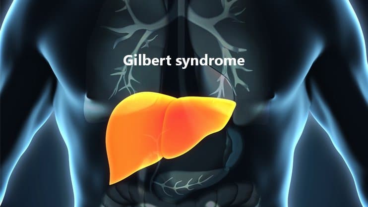Gilbert's Syndrome Diagnosis