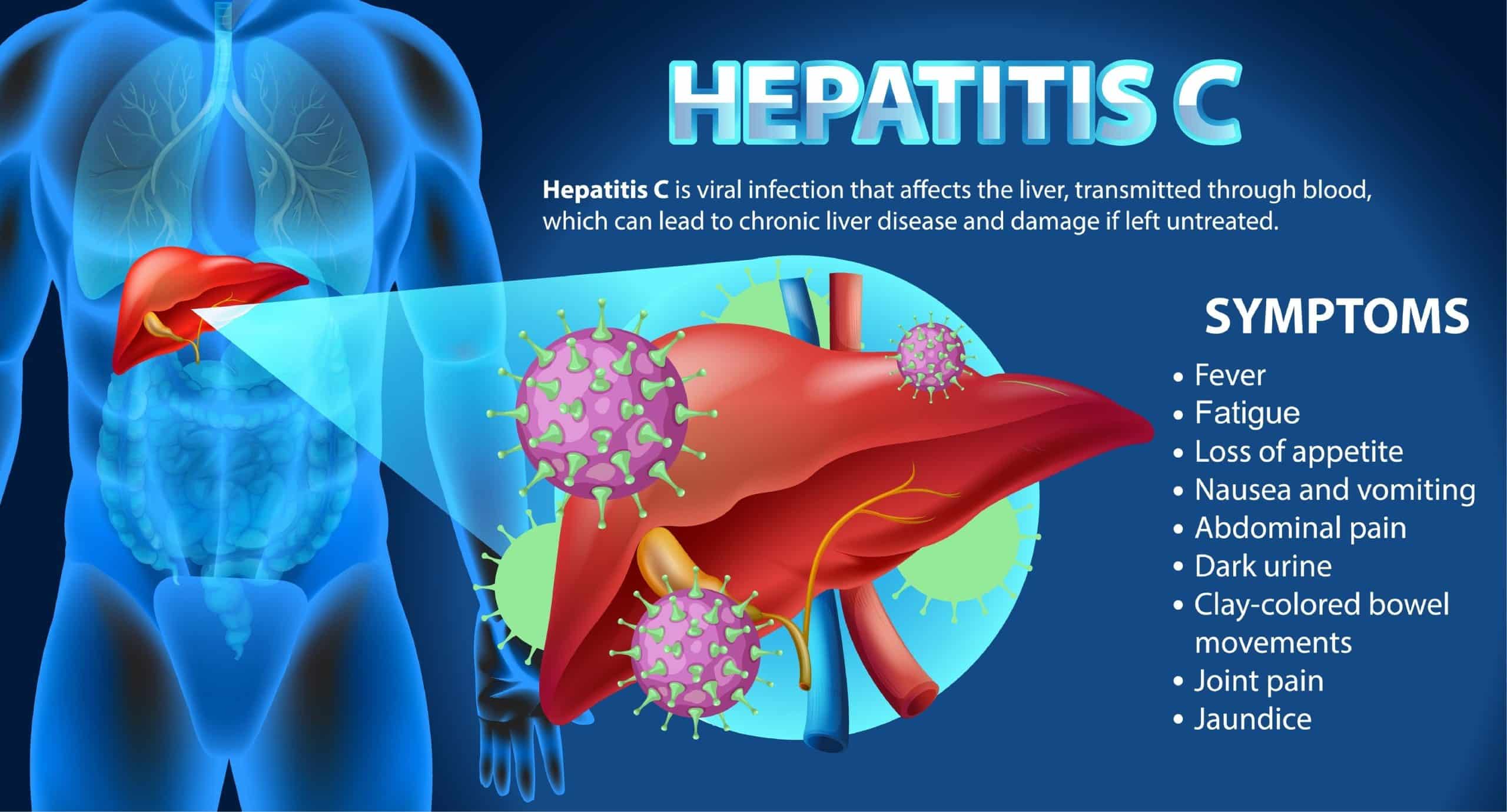 hepatitis c symptoms