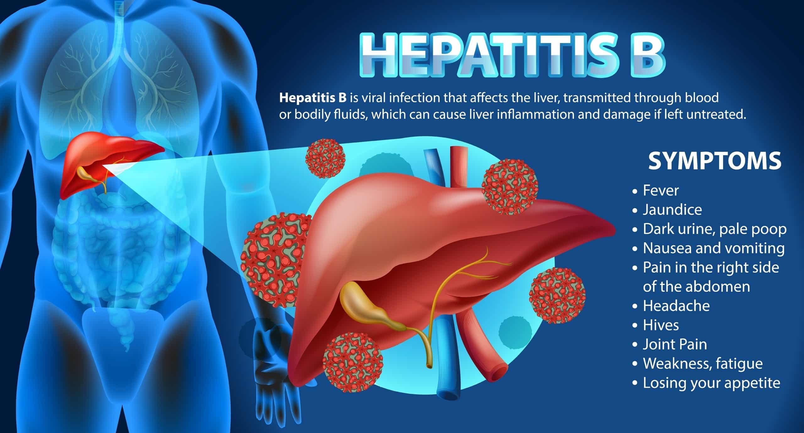 hepatitis b symptoms