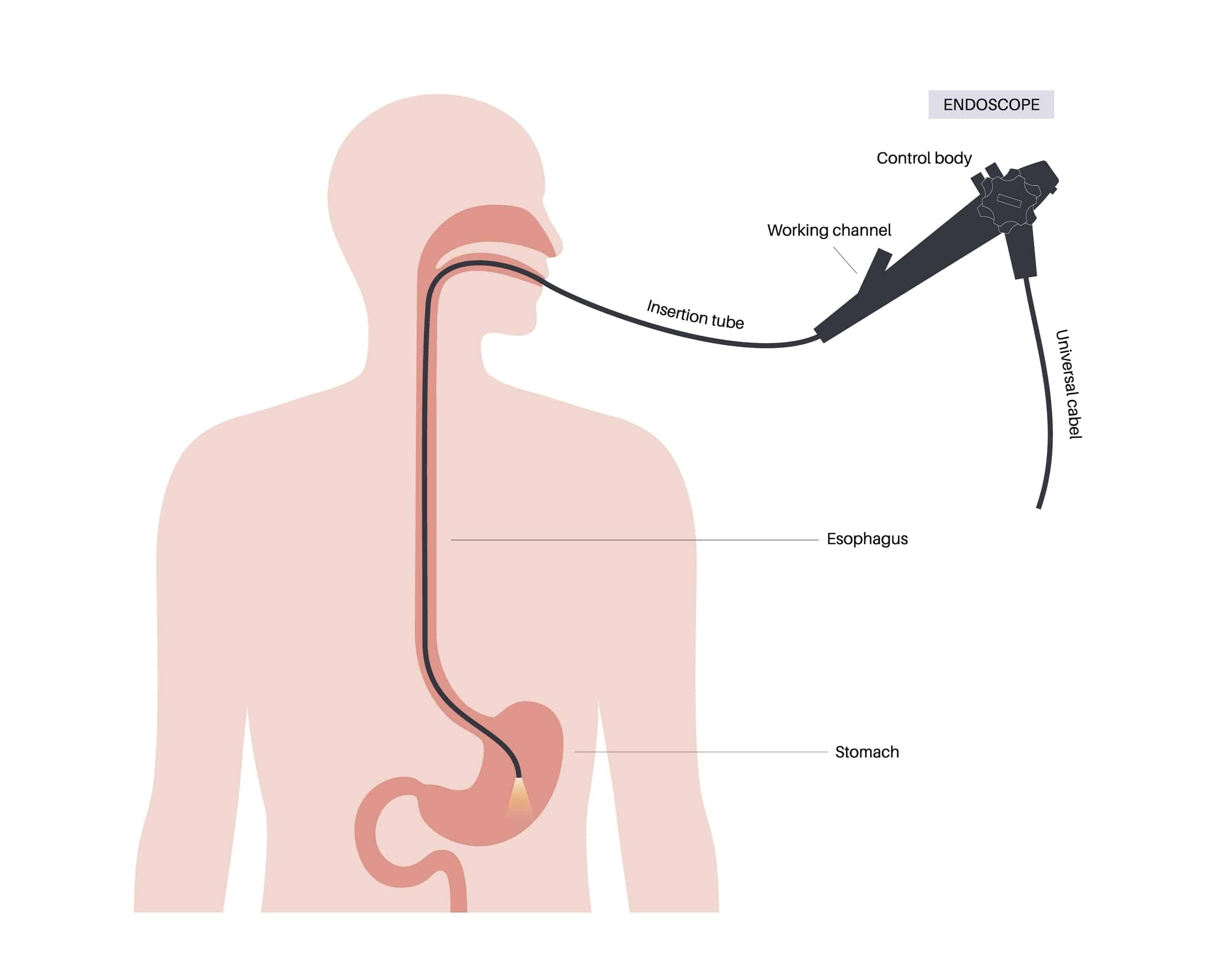 Enteroscopy