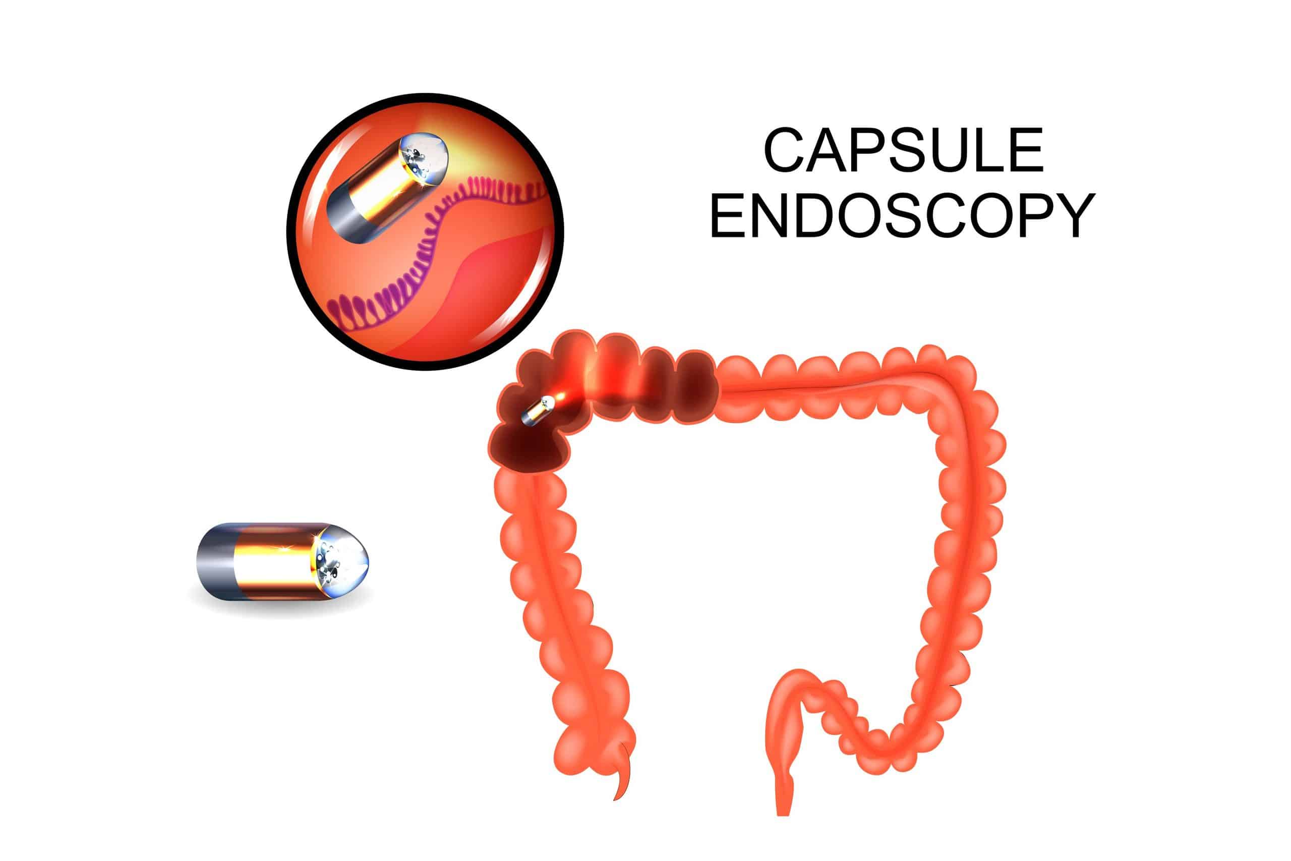 Basic Capsule Endoscopy System